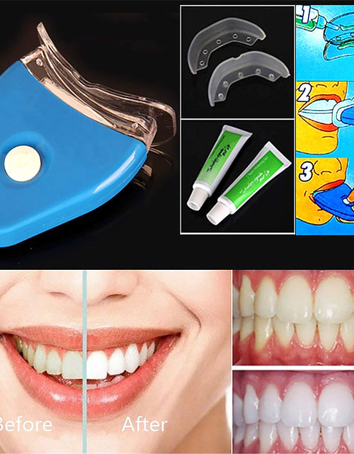 Bild in Galerie-Viewer laden, Oral Gel Zähne Zahnaufhellung Whitener Dental Bleaching LED
